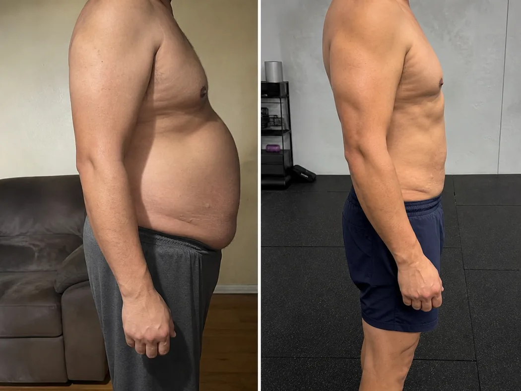 Transformation physique avant et après d'un client, vue de profil